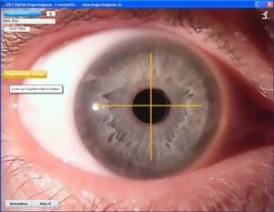  Digitale Augendiagnose DA
