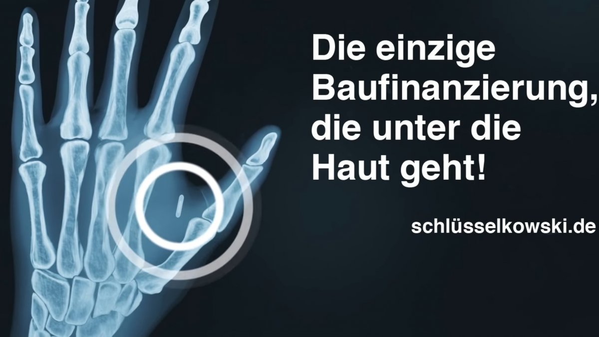 Bio Implantat Von Der Sparda Bank Bei Baufinanzierung Zwei Nfc Chips Gratis Heise Online