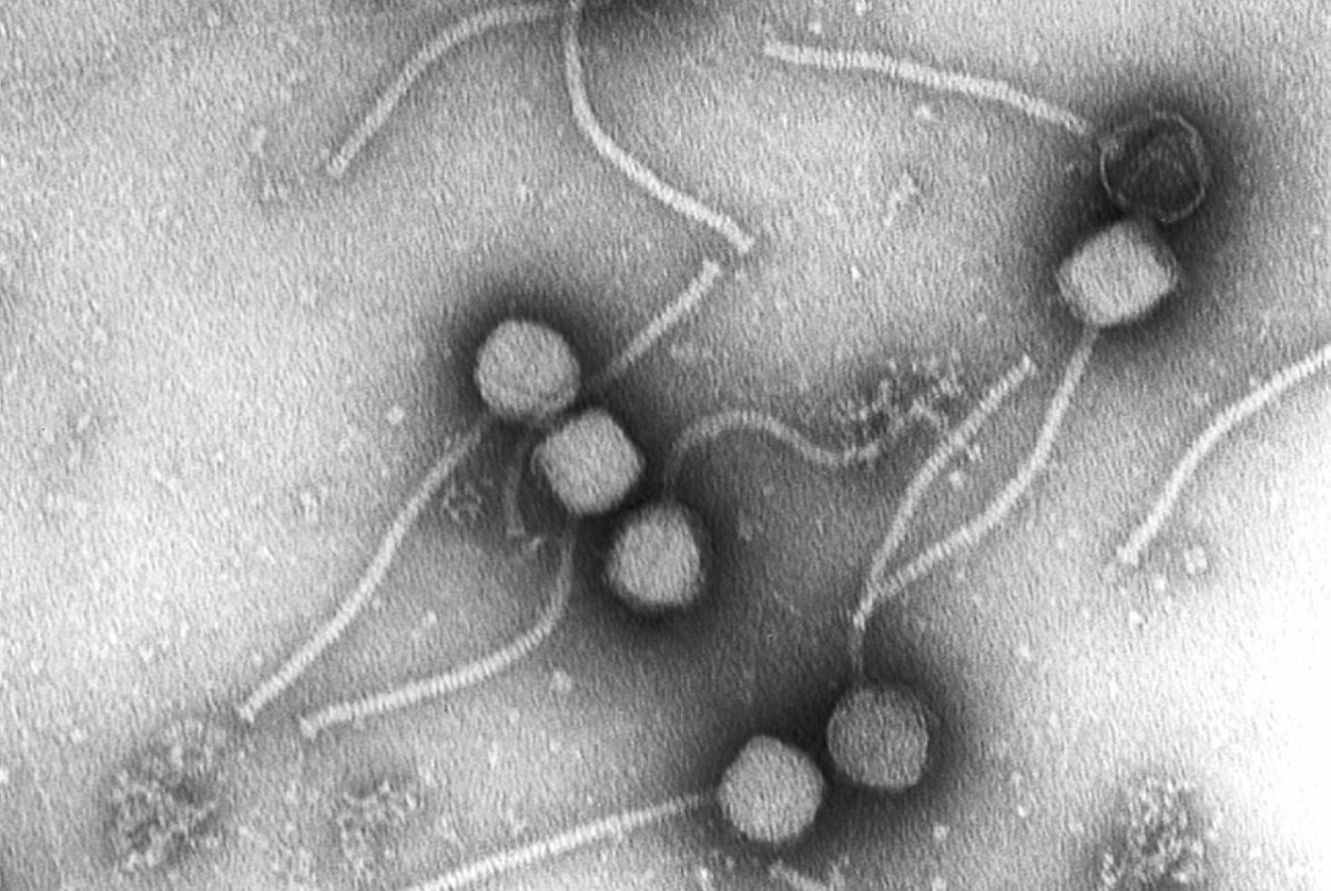 Können Viren Antibiotika ersetzen? Telepolis