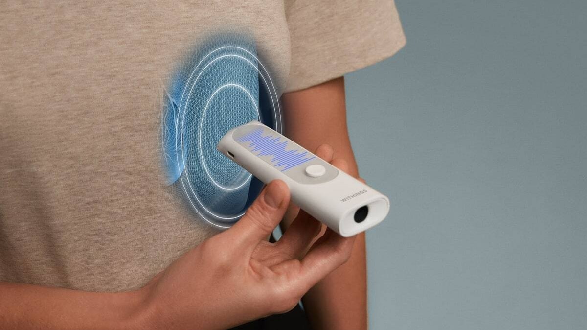 heise-Withings-BeamO-im-Test-Auf-Herz-und-Lunge-h-ren