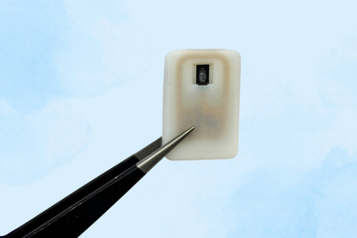Tip 1 Diyabet: Diyabet hastaları için acil implant ile
