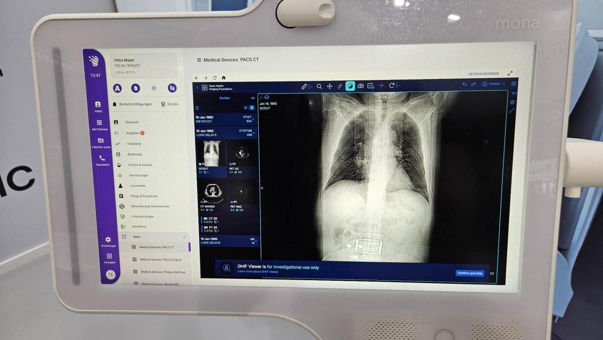 Mona-Aachener-Projekt-stellt-Teleintensivmedizin-f-r-Europa-bereit