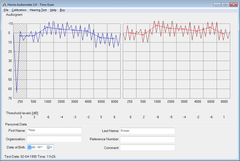 Home Audiometer