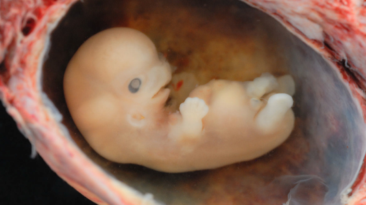 Direkte Genveränderungen an menschlichen Embryonen