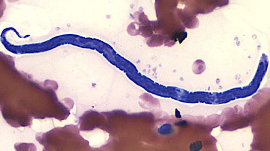CellScope Loa: Smartphone-Mikroskop erkennt Blut-Parasiten