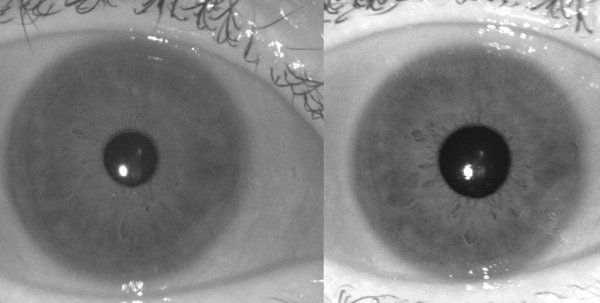 Iris-Aufnahmen von 2011 (links) und 2008 (rechts): Nicht nur die Pupille verändert sich.