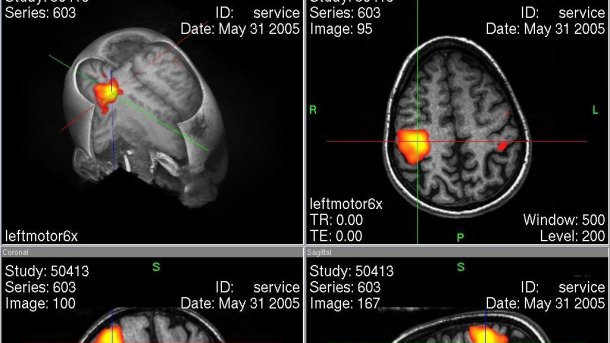 MRI zeigt Langeweile durch Wiederholung