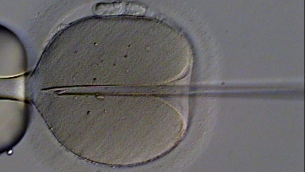 Angesehene Forscher warnen vor neuen Möglichkeiten der Reproduktionsmedizin