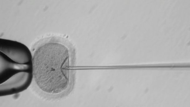 US-Forscher nehmen erstmals Gen-Editierungen an menschlichen Embryos vor