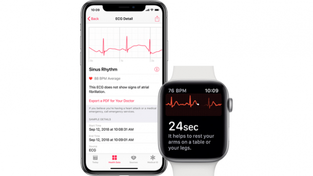 EKG für Apple Watch im Anflug