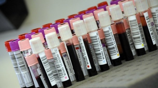 Blutuntersuchung zeigt tatsächliche Coronavirus-Verbreitung