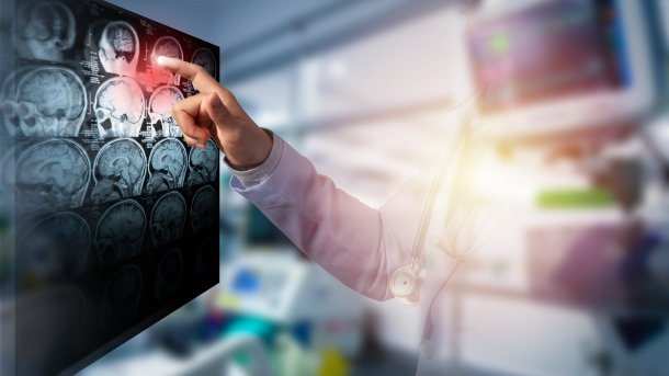 Arzt berührt Bildschirm mit CT-Bildern vom Gehirn. Im Hintergrund ist ein Monitor mit Vitaldaten
