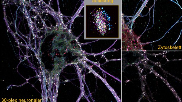 Neuronen als komplexe Proteingebilde