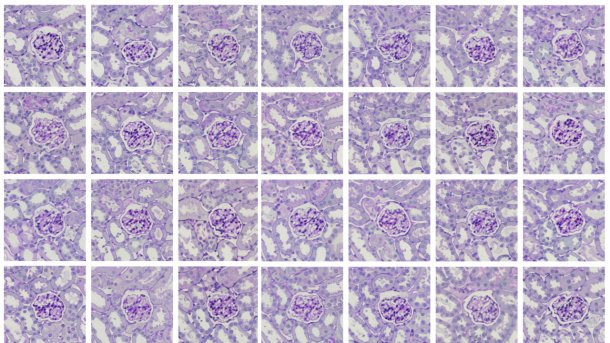 Numerous AI-generated tissue section images side by side (28 pieces)