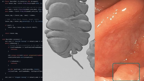 3D intestine for VR simulation and a polyp detected with AI. Code can be seen on the left.