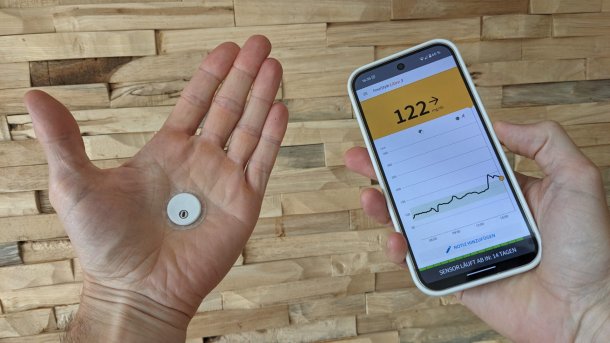 Ein defekter Libre-3-Sensor links auf der Hand mit der zugehörigen App rechts