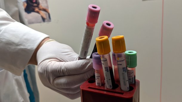 4 Blutprobenröhrchen in einem Ständer, daneben eine Krankenschwester die zwei weitere Röhrchen in die Kamera hält