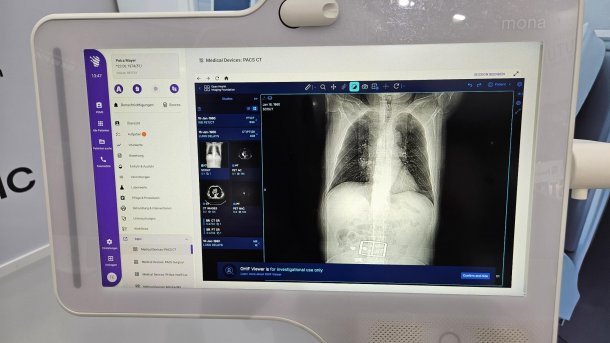 Mona-Plattform für die Intensivmedizin