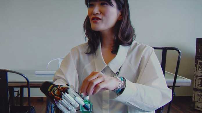 Frau mit Handprothese