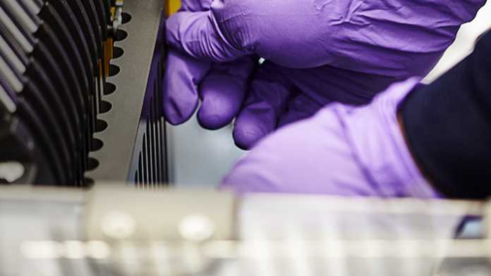 Medikament gegen Alzheimer lässt in Tests Hirn-Plaques verschwinden