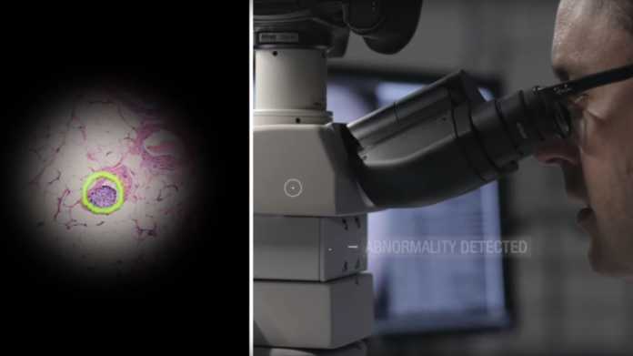 Künstliche Intelligenz: Googles AR-Mikroskop erkennt selbstständig Krebszellen