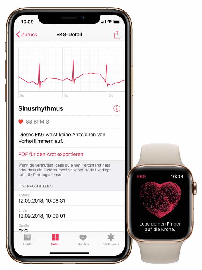 Die Health-App auf dem iPhone speichert die Daten und exportiert auf Wunsch ein PDF für den Arzt.