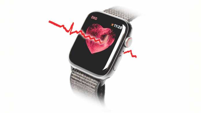 Wie und warum die Apple Watch Vorhofflimmern erkennt