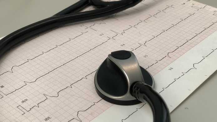 Künstliche Intelligenz: Algorithmus erkennt Herzrhythmusstörung trotz unauffälligem EKG