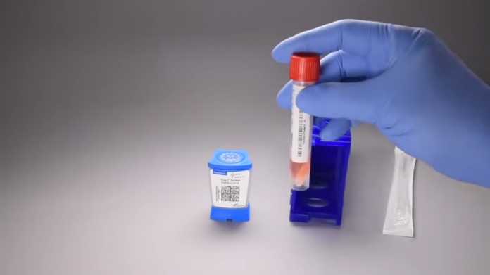 USA: Arzneimittelbehörde erteilt Coronavirus-Schnelltest die Zulassung