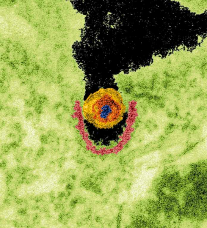 Ein porcines endogenes Retrovirus – kurz PERV – infiziert gerade eine menschliche Wirtszelle. Das haben Forschende bisher jedoch nur in speziellen Laborzelllinien beobachtet, noch nie im Menschen., Ralf Reinhard Tönjes / American Society for Microbiology