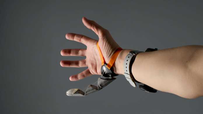 Roboterdaumen an einer menschlichen Hand mit fünf, beziehungsweise sechs, Fingern.