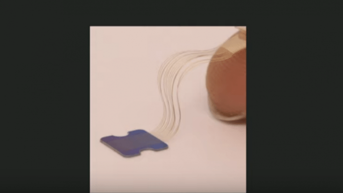 Musks Firma Neuralink setzt Gehirn-Implantat bei Tieren ein