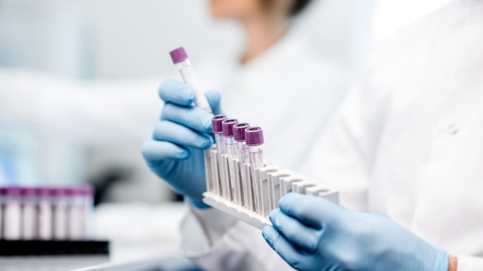 Biotech: Covid-Antikörper als Medikament