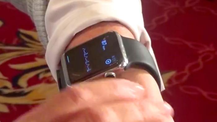 EKG auf der Apple Watch