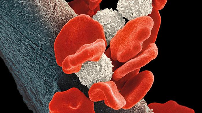 Krebsforschung: Immuntherapie mit CRISPR auf dem Vormarsch