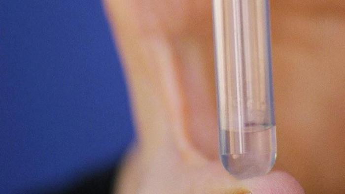 Neue Männerverhütungsmethode legt Samenleiter lahm