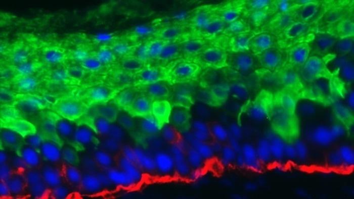 Forscher machen Hautzellen von Mäusen zu Sensoren für die Glukose-Messung