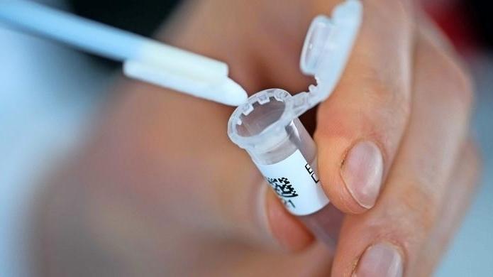 Deutschland will DNA-Phänotypisierung für polizeiliche Zwecke legalisieren