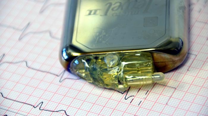 Grüne: Offene Standards für Implantate