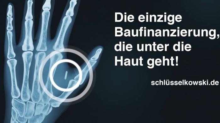 Bio-Implantat von der Sparda-Bank – bei Baufinanzierung zwei NFC-Chips gratis
