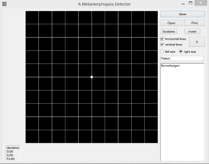 Amd A Metamorphopsia Detector Heise Download